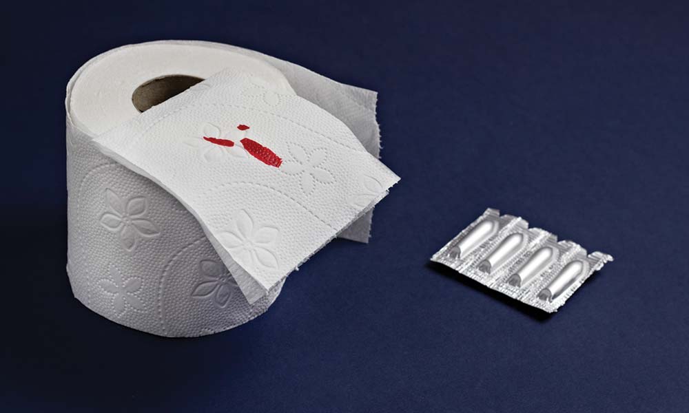 Diagnosing Blood in Stools