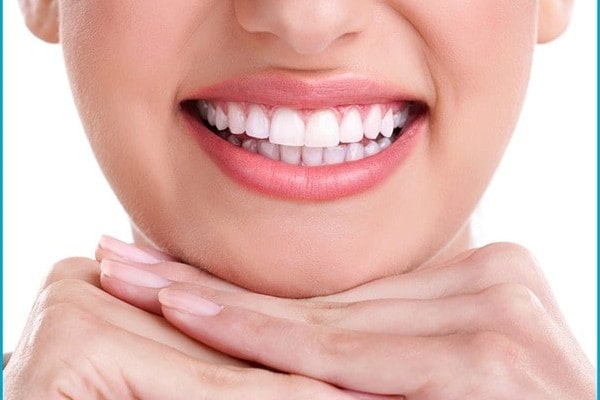 Smile Makeover