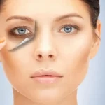 Dark Eye Circles Removal for Brighter Eyes